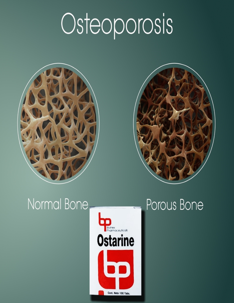 Ostarine MK-2866 Y Osteoporosis